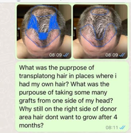 whatsapp message hair transplant clinic 6