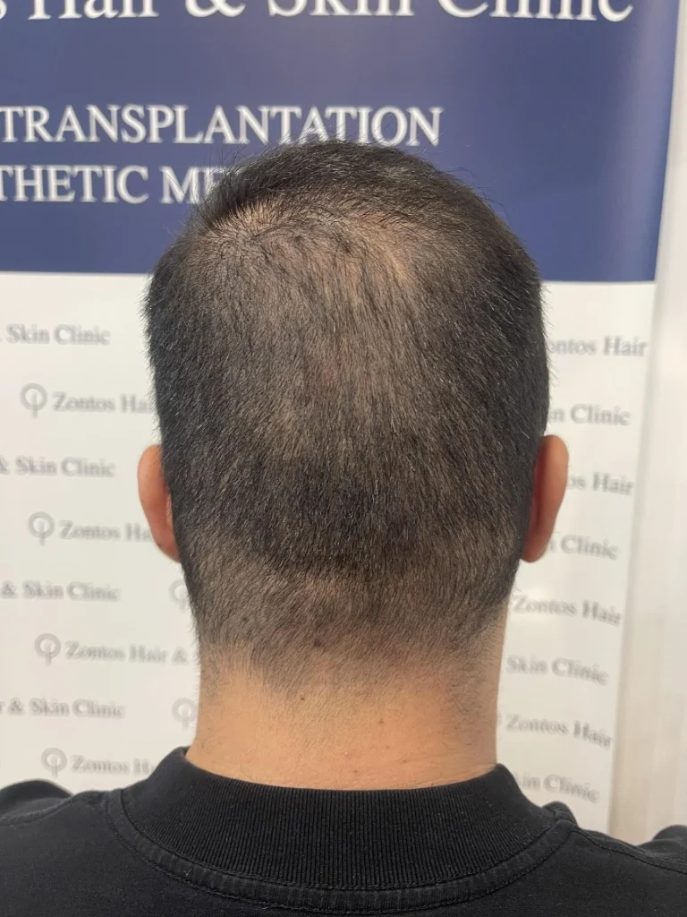 6 months results back