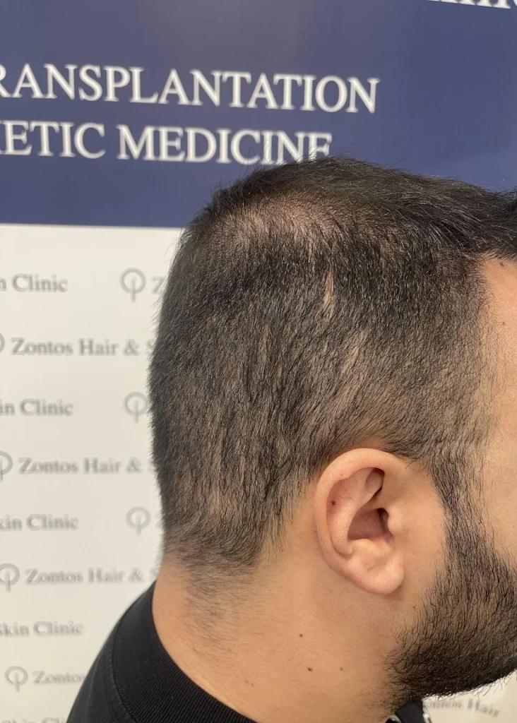 6 months results right