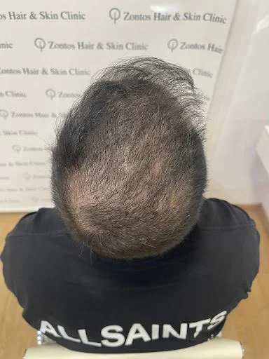 6 months results top